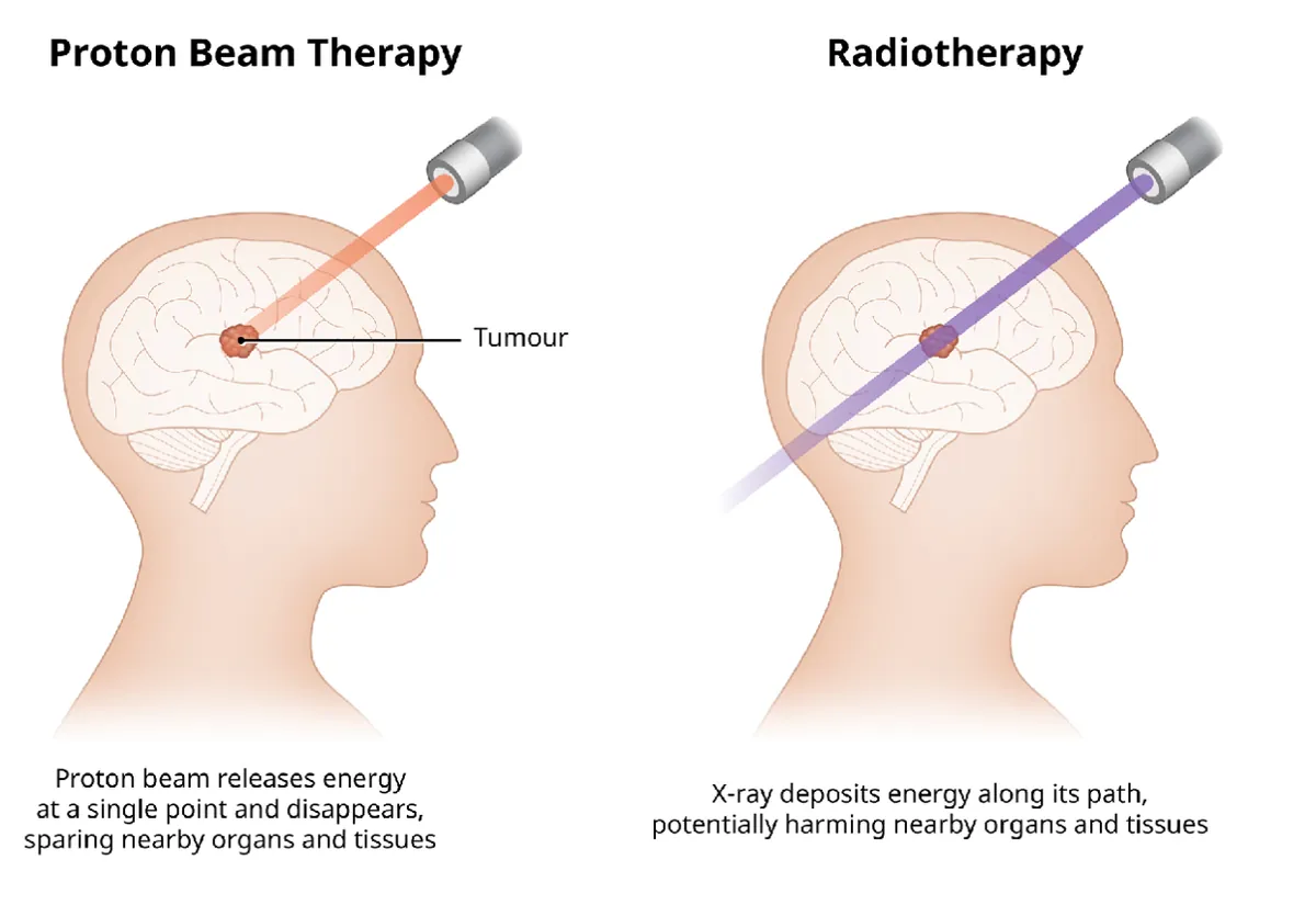 particle-physics-breakthrough-new-hope-for-brain-cancer-treatment